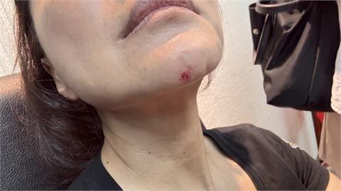 快新聞／立院「上演全武行」！　王鴻薇狂毆林楚茵「下巴見血、緊急送醫」