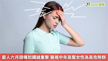 藝人六月頭痛如鐵鎚重擊 醫揭中年高壓女性為高危險群