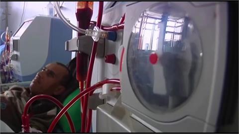 美國男子移植豬腎成功　術後恢復良好成全球唯一存活案例