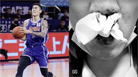 籃球／劉錚搶籃板遭肘擊「鼻樑骨折」　中媒爆：將回台治療