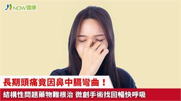 長期頭痛竟因鼻中膈彎曲！結構性問題藥物難根治 微創手術找回暢快呼吸