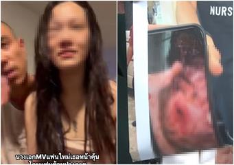有片／女星遭警二代前男友家暴！腫成豬頭還噴血　恐怖囚禁畫面曝光