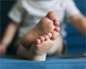 鞋內暗藏真兇！腳趾突發黑像「燒焦」就醫結果出爐了