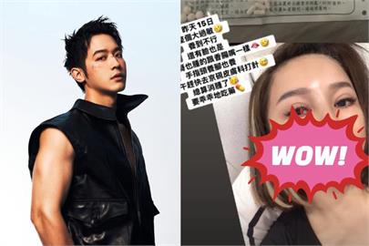 王彩樺「嘴唇腫成香腸」真相曝！現身惹「整形疑雲」她親上火線回應