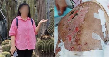 台籍惡看護1／日薪3300顧病父竟徹夜簽賭未歸　雇主怒揭精品包全被打包
