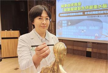 「雷擊般頭痛」騎車自摔！   沒慢性病的她竟是動脈瘤破裂