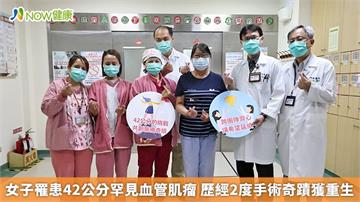 女子罹患42公分罕見血管肌瘤 歷經2度手術奇蹟獲重生