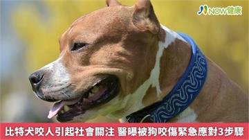 比特犬咬人引起社會關注　醫曝被狗咬傷緊急應對3步驟