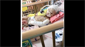 一歲女童腦傷、骨折昏迷指數3 保母：跌倒撞到