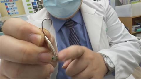 男子東港釣魚「魚鉤刺進眼」　就醫處理奇蹟未傷眼球