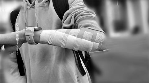 北市某國中傳霸凌！　家長控兒遭同學過肩摔「留13公分傷痕」怒提告