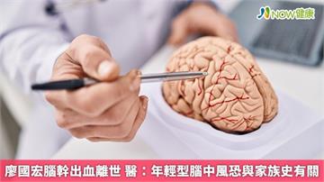廖國宏腦幹出血離世 醫：年輕型腦中風恐與家族史有關