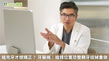植完牙才想矯正? 牙醫揭:植錯位置恐整顆牙拔掉重做