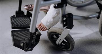 以為拉傷!腳後跟疼半年竟是阿基里斯腱斷裂 她慘錯過黃金治療期