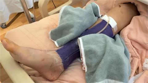 騎士雙載撞上公車車尾　兩人摔車滾數圈險被輾