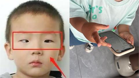 5歲男童狂玩手機⋯家長驚見「黑眼珠消失」！醫示警1事：恢復可能性很低
