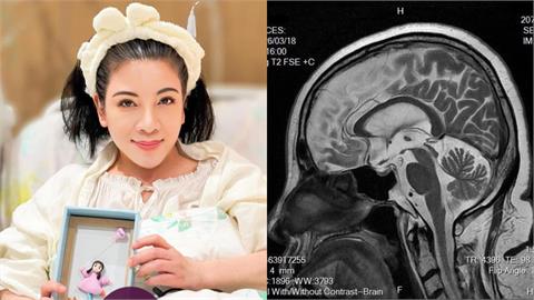 陳文茜抗癌多年「突爆MRI沒癌細胞」！遭酸「怎還沒S」本人親回嗆6字了