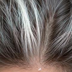 長白髮先別慌!最新研究:「可能是身體在殺死壞細胞」