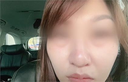 吃腸粉雙眼紅腫？　民眾疑食材不新鮮　業者澄清