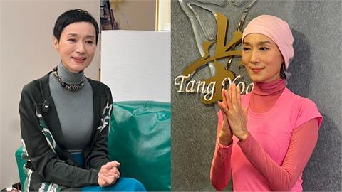 坣娜傳逝世曾曝被「紅斑性狼瘡」纏8年 嘆像「火燒身」看淡病況吐4字