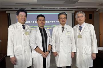 少見巨大黑色素瘤「吃掉眼球一半」！   北榮高難度手術保住視力