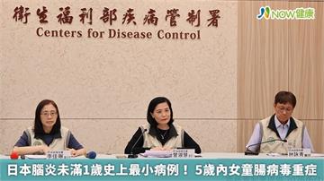 日本腦炎未滿1歲史上最小病例！ 5歲內女童腸病毒重症