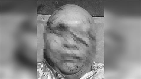 快新聞／愼入！「百億賭王」林秉文遭狙擊29槍身亡　慘狀曝光