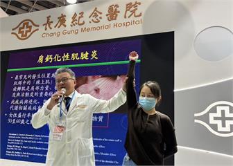 穿脫衣服卡卡、睡覺翻身痛醒…   「三症狀」小心肩鈣化性肌腱炎