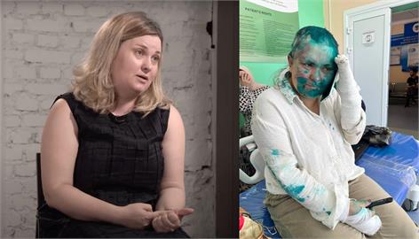 快新聞／俄女記者車臣遇襲　遭毒打、剃髮還被潑漆