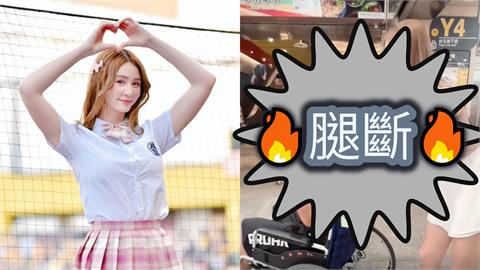 旅台日男星「慘遭重物壓制」腿斷出事了！短今「尷尬推輪椅」畫面嚇壞網：好可怕