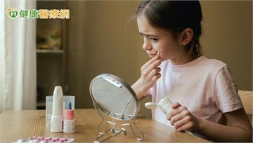 家有幼兒請留心！　含「薄荷」藥膏恐引發呼吸停止