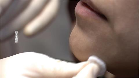 妹子砸9萬醫美「臉凹陷變形」崩潰求償！竟遭診所羞辱：你本來就長不好看