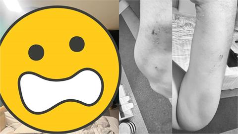 商旅「天花板整片崩塌」狠砸躺床旅客！妻氣炸曬「超扯畫面」業者急喊聲了