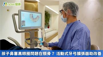 孩子鼻塞黑眼圈問題在顎骨？ 活動式牙弓擴張器助改善