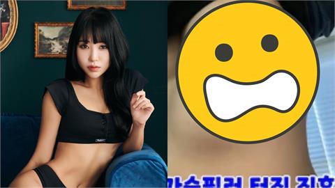 女星砸千萬隆乳慘變惡夢！填充物下垂到肋骨變「4個胸部」畫面首度公開
