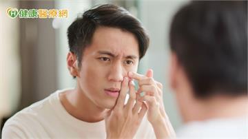 高三生壓力大狂嗑炸雞、手搖「吃出滿臉痘」 ！醫教甩爛臉秘訣