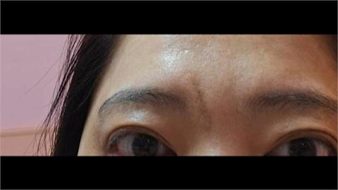 美體ＳＰＡ痛到「昏厥撞破頭」　女律師怒提告過失傷害、詐欺