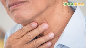 8旬翁脖子腫塊多到如「整串葡萄」鼻咽驗嘸癌細胞竟仍確診鼻咽癌