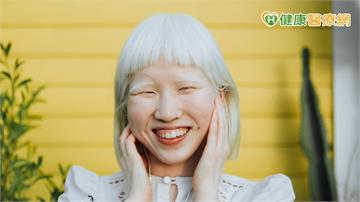 白化症對光線異常敏感！ 醫告訴你「保護視力的方法」：小心紫外線
