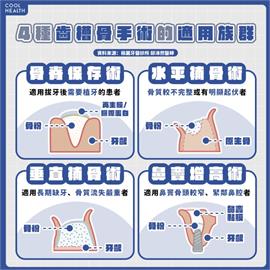 口腔環境的「地基主」！拔牙後必知「齒槽骨保存術」