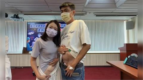 鶼鰈情深！不捨尪洗腎受苦　妻「達文西手術」捐腎救夫大成功
