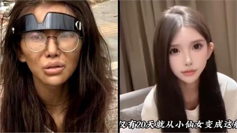 被男友騙至柬埔寨！　中國網紅雙腿疑骨折被丟路邊