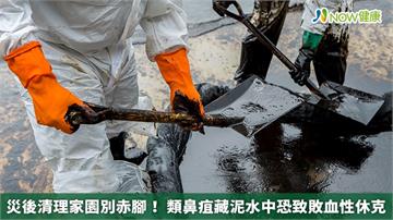 災後清理家園別赤腳! 類鼻疽藏泥水中恐致敗血性休克