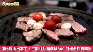連吃烤肉出事了！三酸甘油脂飆破800 引爆急性胰臟炎