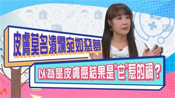 (影)／林姿佑皮膚莫名潰爛宛如惡夢 原來是「它」惹的禍？