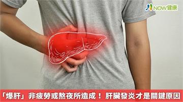 「爆肝」非疲勞或熬夜所造成！ 肝臟發炎才是關鍵原因