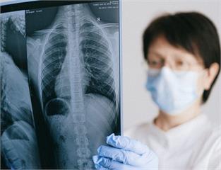 台灣千人普查揭恐怖「心肺共病」! 染肺阻塞6成難逃心血管風險