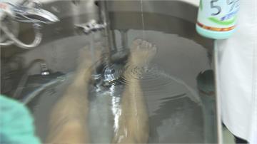 治療異位性皮膚炎 醫界認可「漂白水泡澡」有效