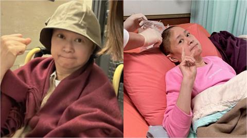 王月暈倒撞頭「二度手術花35萬」復原顱骨！老友PO照「最新近況」曝光