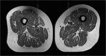 大腿肌肉變「A5和牛」！　研究：小心吃太多超加工食品